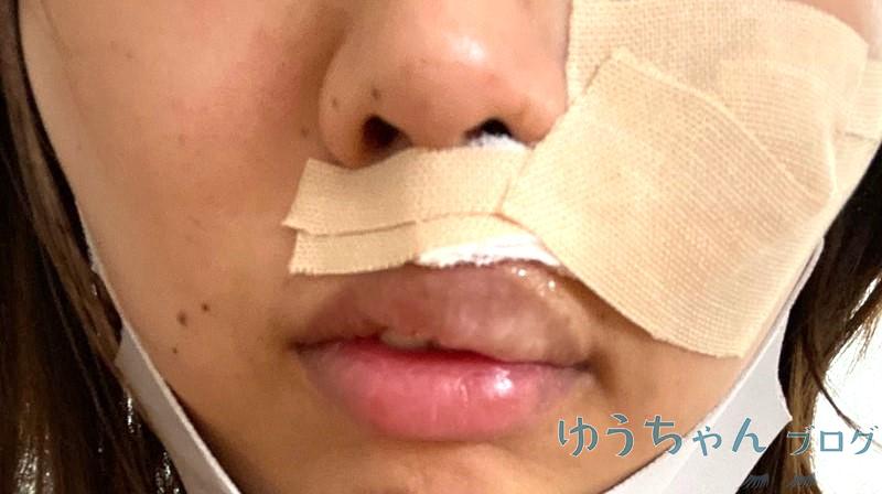 手術直後の写真